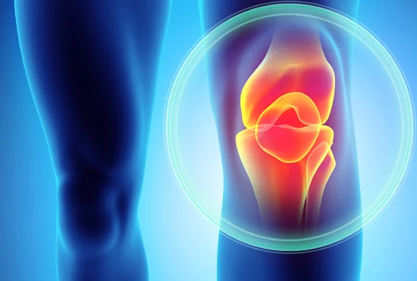 Orthopedics